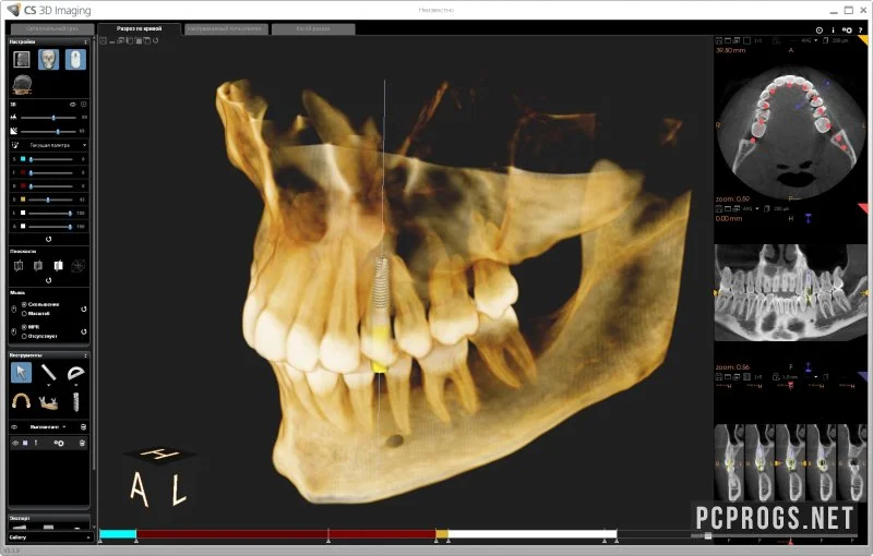 CS 3D Imaging Software — изображение 1