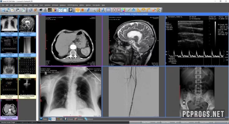 Sante DICOM Editor — изображение 2