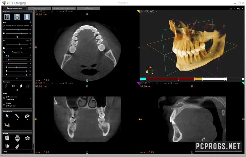 CS 3D Imaging Software — изображение 2