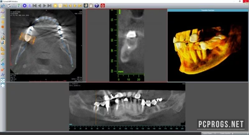Sante DICOM Editor — изображение 3