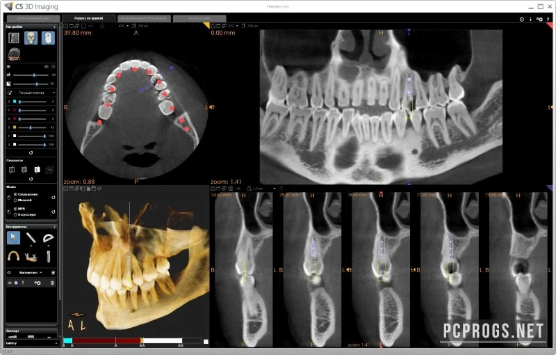 CS 3D Imaging Software — изображение 3