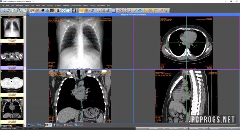 Sante DICOM Editor — изображение 1