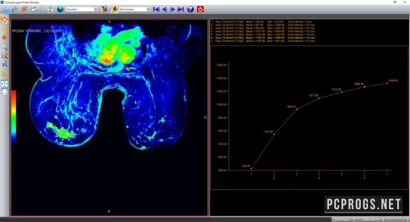 Sante DICOM Editor — изображение 4